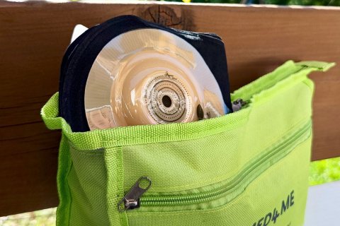 Stomia od kuchni. Jak dbać o skórę wokół stomii podczas upałów?