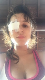 kaszuba blog zapalenie.jpg