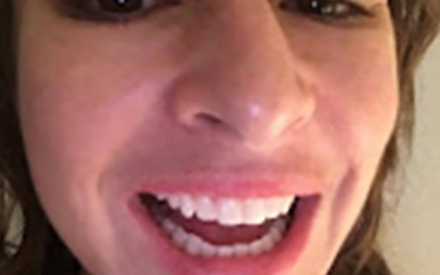 Śnieżnobiały uśmiech